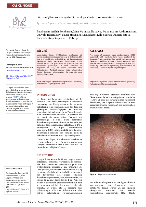 (PDF) Systemic lupus erythematosus and psoriasis a rare association Lala Soavina Ramarozatovo