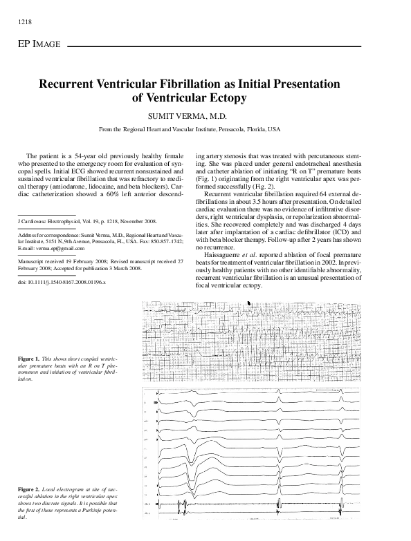 (PDF) Recurrent Ventricular Fibrillation as Initial Presentation of ...