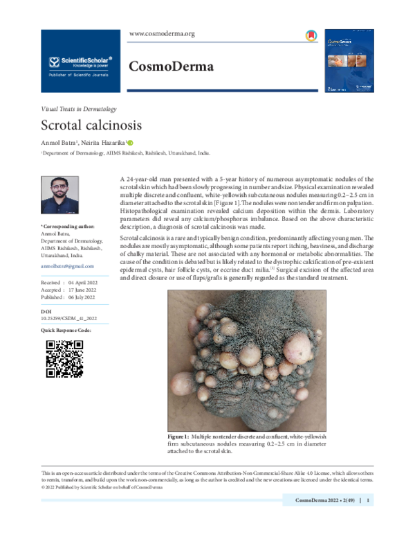 (PDF) Scrotal calcinosis
