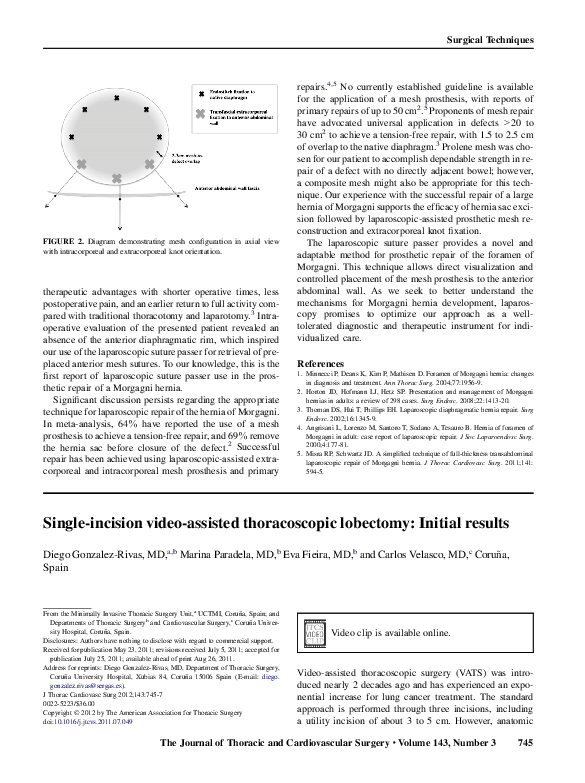 (PDF) Single-incision video-assisted thoracoscopic lobectomy: Initial ...