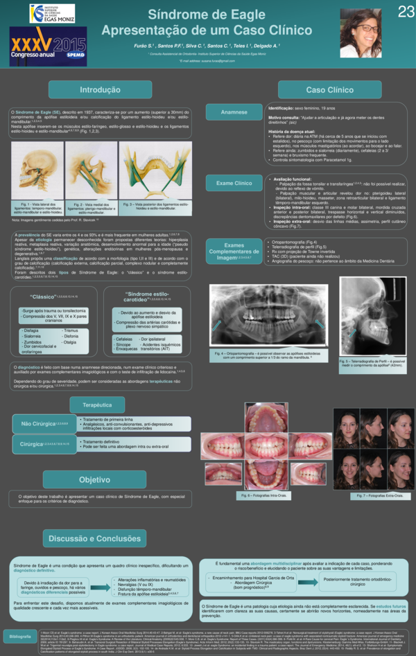 # 22. Síndrome de Eagle – Apresentação de um caso clínico
