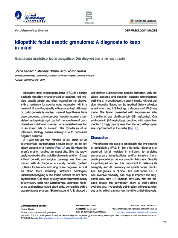 (PDF) Idiopathic facial aseptic granuloma A diagnosis to keep in mind
