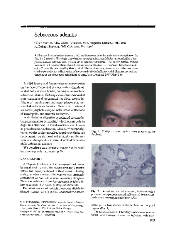 (PDF) Sebaceous adenitis