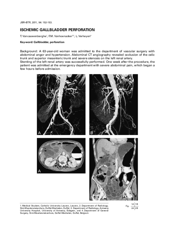 (PDF) Ischemic gallbladder perforation