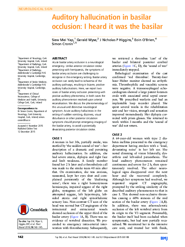 Pdf Auditory Hallucination In Basilar Occlusion I Eoin O Brien