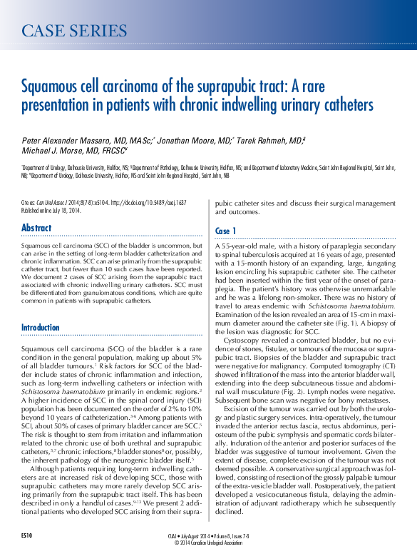 (PDF) Squamous Cell Carcinoma of the Suprapubic Tract: A Rare ...
