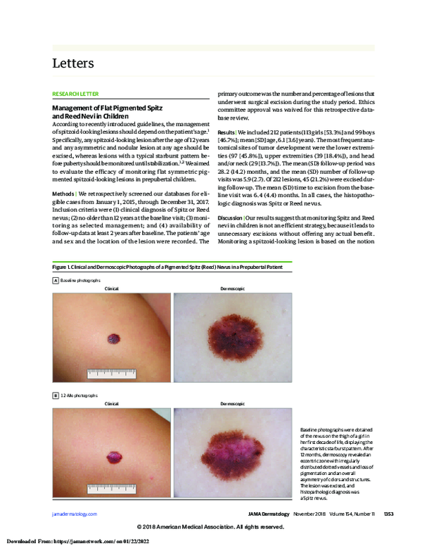 (PDF) Management of Flat Pigmented Spitz and Reed Nevi in Children
