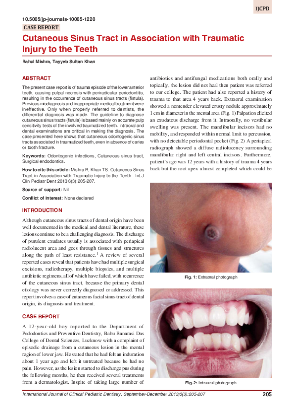 (PDF) Cutaneous sinus tract in association with traumatic injury to the ...