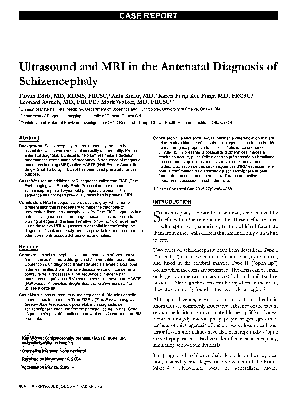 (PDF) Ultrasound and MRI in the Athenatal Diagnosis of Schizencephaly