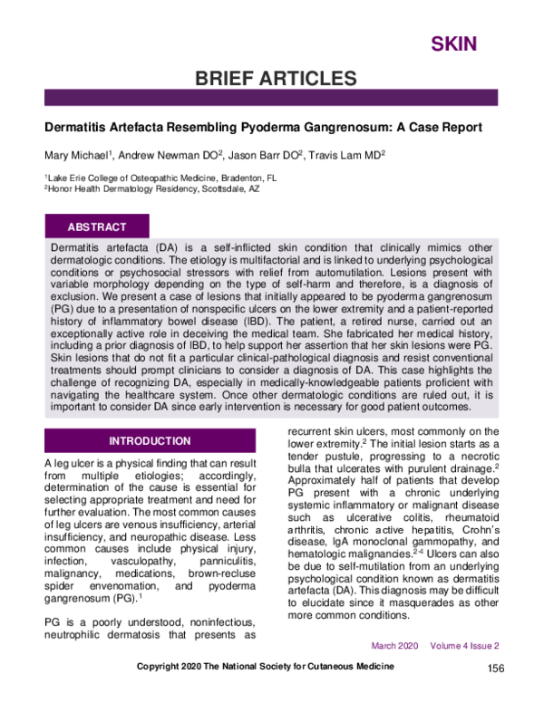 (PDF) Dermatitis Artefacta Resembling Pyoderma Gangrenosum