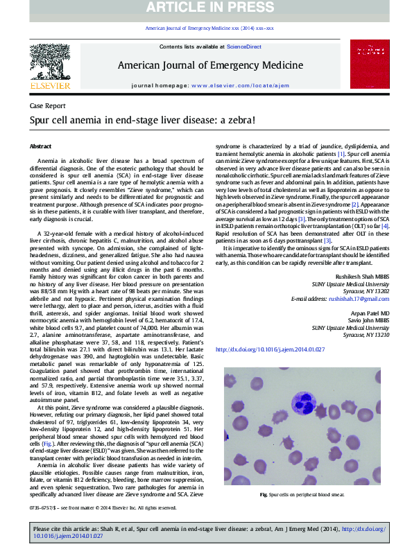 (PDF) Spur cell anemia in endstage liver disease a zebra! Arpan