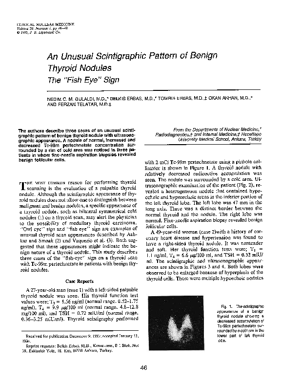 (PDF) An Unusual Scintigraphic Pattern of Benign Thyroid Nodules The ...