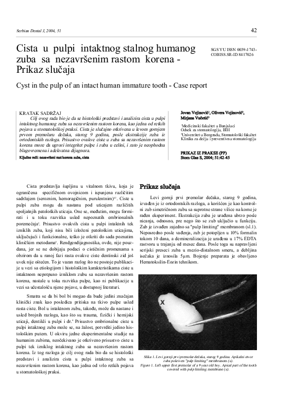 (PDF) Cyst in the pulp of an intact human immature tooth: Case report