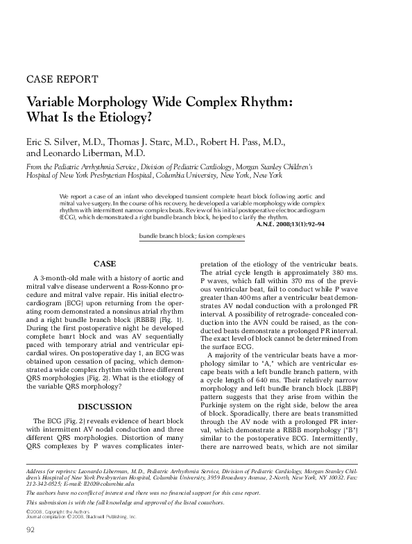 (PDF) Variable Morphology Wide Complex Rhythm: What Is the Etiology?