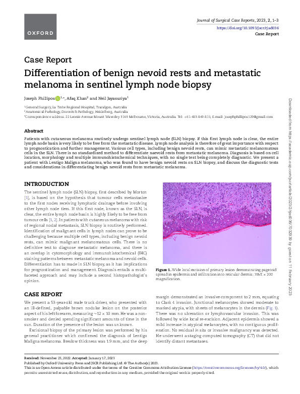 (PDF) Differentiation of benign nevoid rests and metastatic melanoma in ...