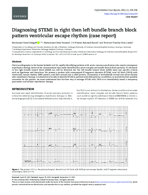 (PDF) Diagnosing STEMI in right then left bundle branch block pattern ...