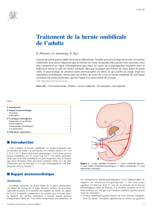 (PDF) Traitement de la hernie ombilicale de l'adulte — free download