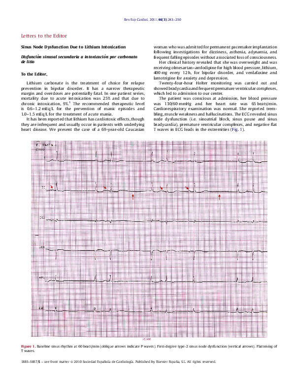 (PDF) Sinus Node Dysfunction Due to Lithium Intoxication
