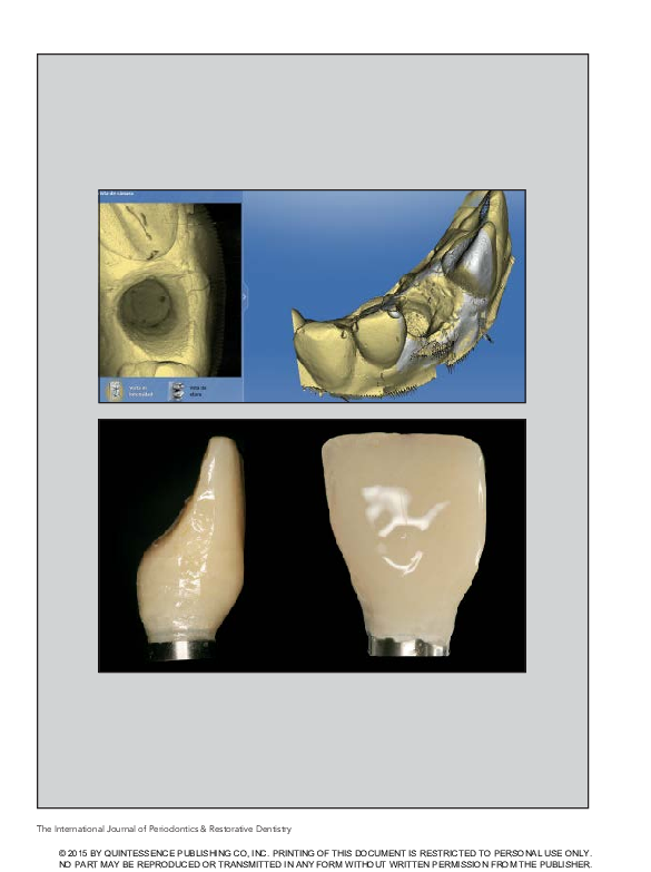 (PDF) Comparison of Direct and Indirect Techniques to Develop