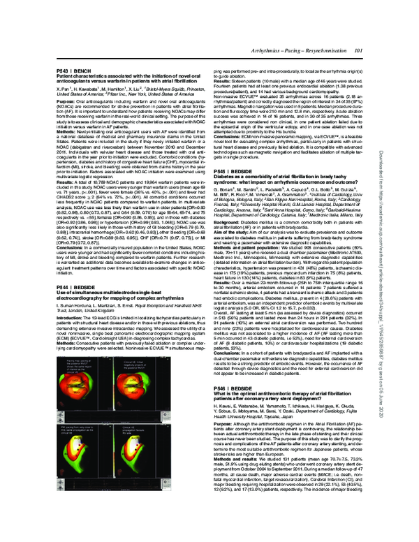 (PDF) Diabetes as a comorbidity of atrial fibrillation in brady tachy