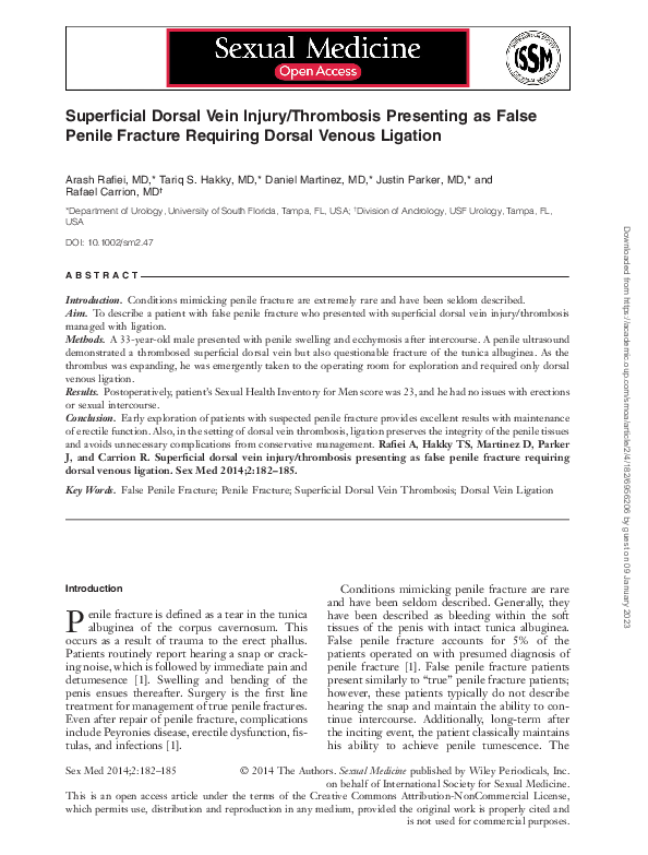 Superficial dorsal vein injury/thrombosis presenting as false penile fracture requiring dorsal venous ligation