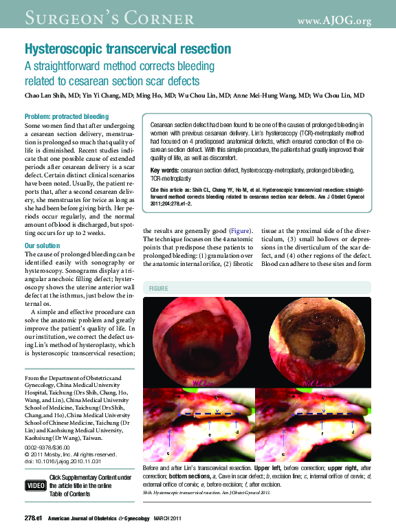 (PDF) Hysteroscopic transcervical resection