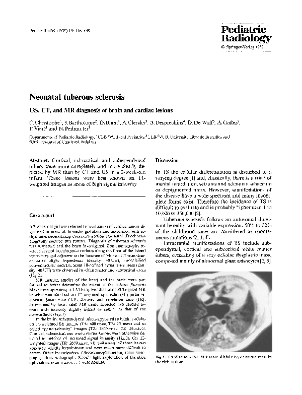 (PDF) Neonatal tuberous sclerosis