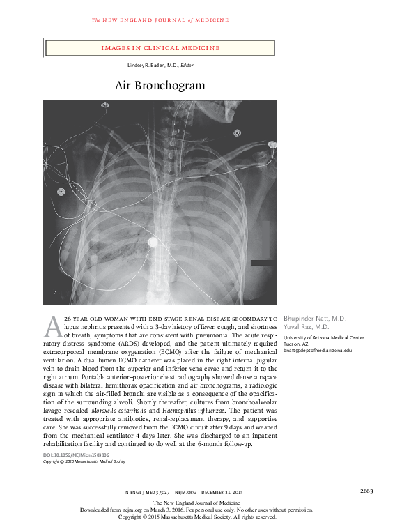(PDF) Air Bronchogram | Yuval raz - Academia.edu