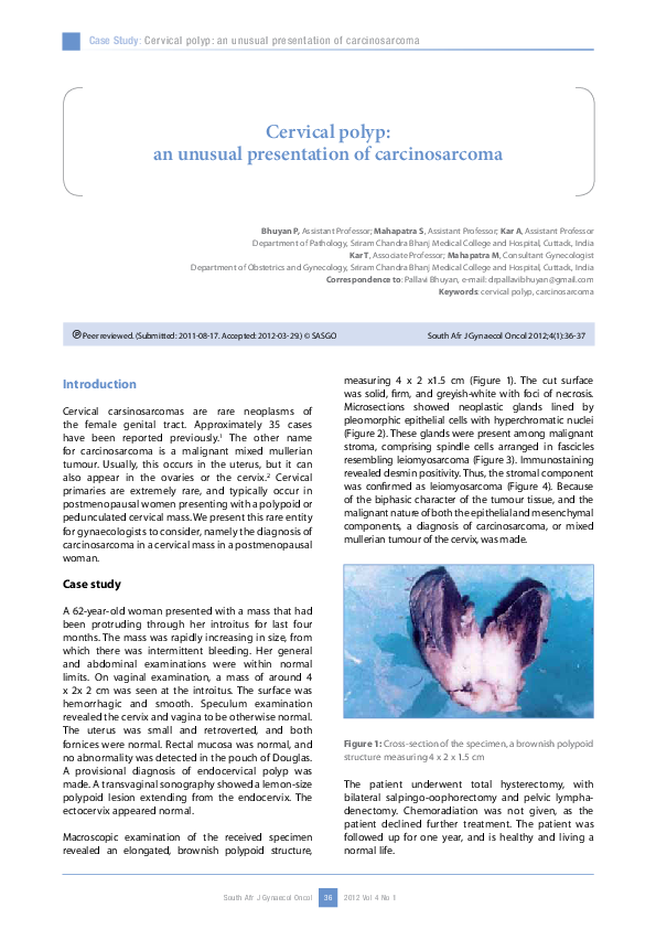 (PDF) Cervical polyp: an unusual presentation of carcinosarcoma